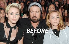 Dad billy ray cyrus also posted a sweet throwback video to instagram of his. 17 Year Old Noah Cyrus Got Some Extreme Plastic Surgery Mto News