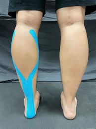 Image result for Taping for Soleus and Achilles