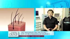 Sac Mezoterapi Sac Prp Ve Sac Kok Hucre Uygulamalari Nelerdir Dr Huseyin Tirman Youtube