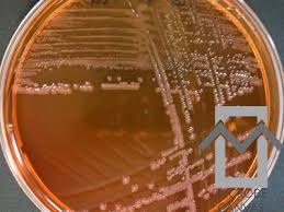 Image result for yersinia fotos