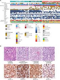 Image result for Intestinal Enteropathy