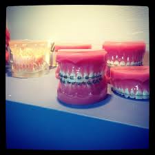 Maybe you would like to learn more about one of these? How To Floss With Permanent Retainer Arxiusarquitectura