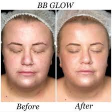 • work with all the zones of the face without. 8 Bb Glow Ideen Okologisch Leben Schonheit Schonheit Madchen