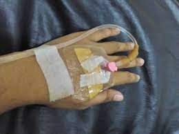  Paling Bagus 16 Gambar Tangan Di Infus Anak Remaja Menggambar Tangan Infeksi Saluran Kemih Foto Tangan