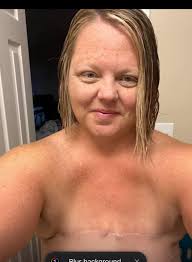 Olivia Munn has changed her mind about treating scars from her mastectomy.  See below for the full story ⬇️.