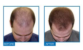 11 hair serums that really work, according to our beauty scientists. Is There Any Medicine For Hair Regrowth Steemit