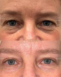 The Clinic Holland Park