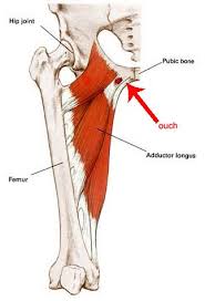 Pin On Rightpain