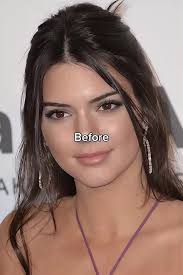 Kendalljenner Avant