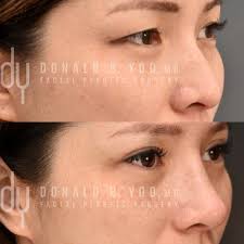 Donald B Yoo, MD, FACS, 433 N Camden Dr, Ste 970, Beverly Hills, CA 90210,  US