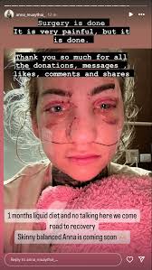 Brit, 32, unable to eat or talk after scooter smash in Thailand…& left her  with £7k bill because of the BIKE she chose