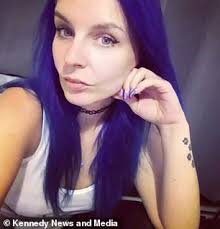 Woman's head is deformed by a severe allergic reaction to eyebrow tint