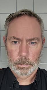 Have you experienced hairfall after keeping a beard?