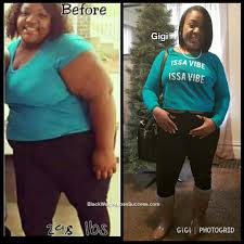 Pin On Before And After Weight Loss Stories