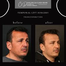 Doç.Dr.Can İlker Demir