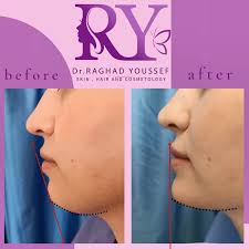 Dr Raghad youssef (@dr.raghad.youssef) • Instagram photos and videos