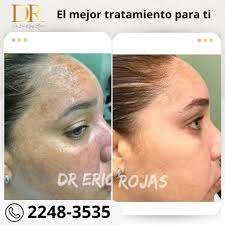 Dr. Eric Rojas Blanco telah...