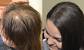 Extensions For Thin Hair Before And After