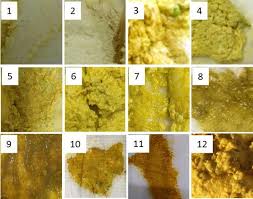 Image result for yellow stool human poop