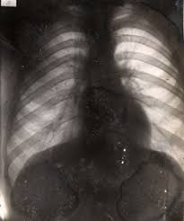 Radiology Medicine In The First World War