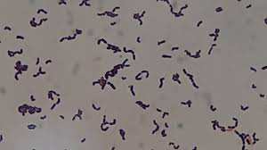 Image result for Group D Streptococcus