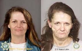 How Meth Destroys The Body