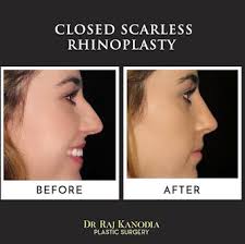 Reviews Dr. Raj Kanodia Medical Group (Plastic Surgery) in California