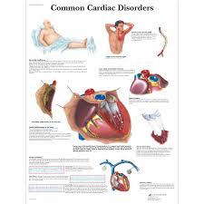 common cardiac disorders chart