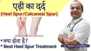 Translate english word spur in hindi with its transliteration. Heel Spur Or Calcaneal Spur How To Cure Heel Pain à¤à¤¡ à¤• à¤¦à¤° à¤¦ à¤• à¤¸ à¤  à¤• à¤•à¤° Youtube