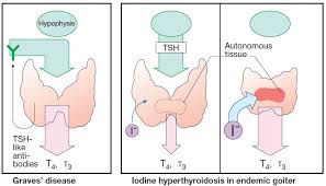 Hyperthyroidism And Antithyroid Drugs Manual Of Medicine