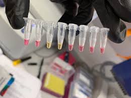 Please contact jim haseloff (jh295 at cam.ac.uk for more details). Jim Haseloff On Twitter Two New Preprints Describing Simple Colorimetric Lamp Testing For Sars Cov 2 Https T Co Xlp0rc72xw And Https T Co B9wwe7cscg With News Coverage At Https T Co 4iwmj89yga Https T Co Hvimfmxmyp