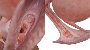 Image result for genital herpes