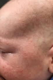 Babyhaut Hallohebamme