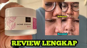 REVIEW Lengkap Scarlett Acne Day Cream (Honest Review)