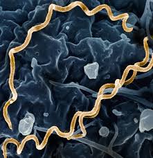 Image result for syphilis symptoms