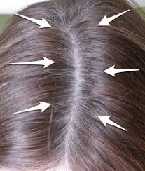 Inexpensive Way To Cover Grey Hair Between Colorings Before And After Pic To Show That It Works Too Covering Gray Hair Cover Gray Hair Roots Roots Hair