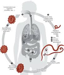 Une personne infectée par le strongyloïde peut être. Parasitoses Et Mycoses Des Regions Temperees Et Tropicales