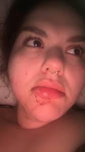 Struggling to stay sober after multiple relapses