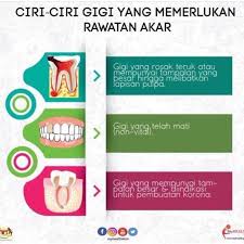 Apabila kita membuat rancangan rawatan untuk memulihkan seluruh mulut dengan implan pergigian, seringkali merangkumi pelbagai pilihan. Rawatan Akar Gigi Anda Pernah Klinik Pergigian Smile Facebook