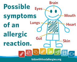Although it's hard to resist those puppy dog eyes at the dinner table, it may not always be safe to feed your canine companion the same foods you eat. Food Allergy Reminder Be Prepared For Anaphylaxis Kids With Food Allergies