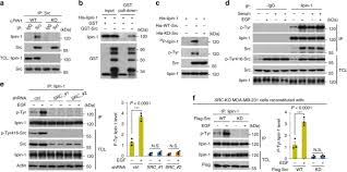 La articolul 55 alineatul (1): Proto Oncogene Src Links Lipogenesis Via Lipin 1 To Breast Cancer Malignancy Nature Communications