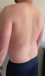 It connects with the collarbone at the front of the body. The Four Body Types Fellow One Research