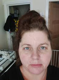 Dealing with fibromyalgia misconceptions