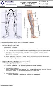 En un principio se puede ver que las venas varices aumentan de tamaño hasta convertirse en una especie de cordón duro al tacto. Trombosis Venosa Profunda Tvp Y Tromboflebitis Superficial Pdf Descargar Libre