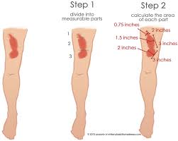 Military Disability Rating For Scars