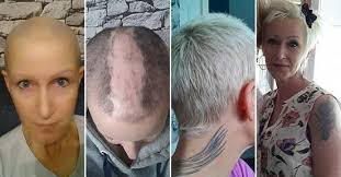 It could be down to a range of factors, such as stress, genetics, hormones or illness, and can happen at any age. Hair Growth Shampoo Conditioner Set Hair Growth Shampoo Grow Hair Natural Hair Shampoo