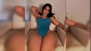 Woman Bullied For Abnormally Thick Legs Suffer From A Rare, Incurable  Condition | Health - Times Now