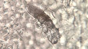 Image result for Demodex brevis