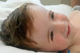 Brave John McElduff (7) defies horror injuries to ride bike for first time 