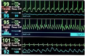 Lung cancer usually has no symptoms in its early stages. Infantile Bradycardia Causes Diagnosis Symptoms And Treatment